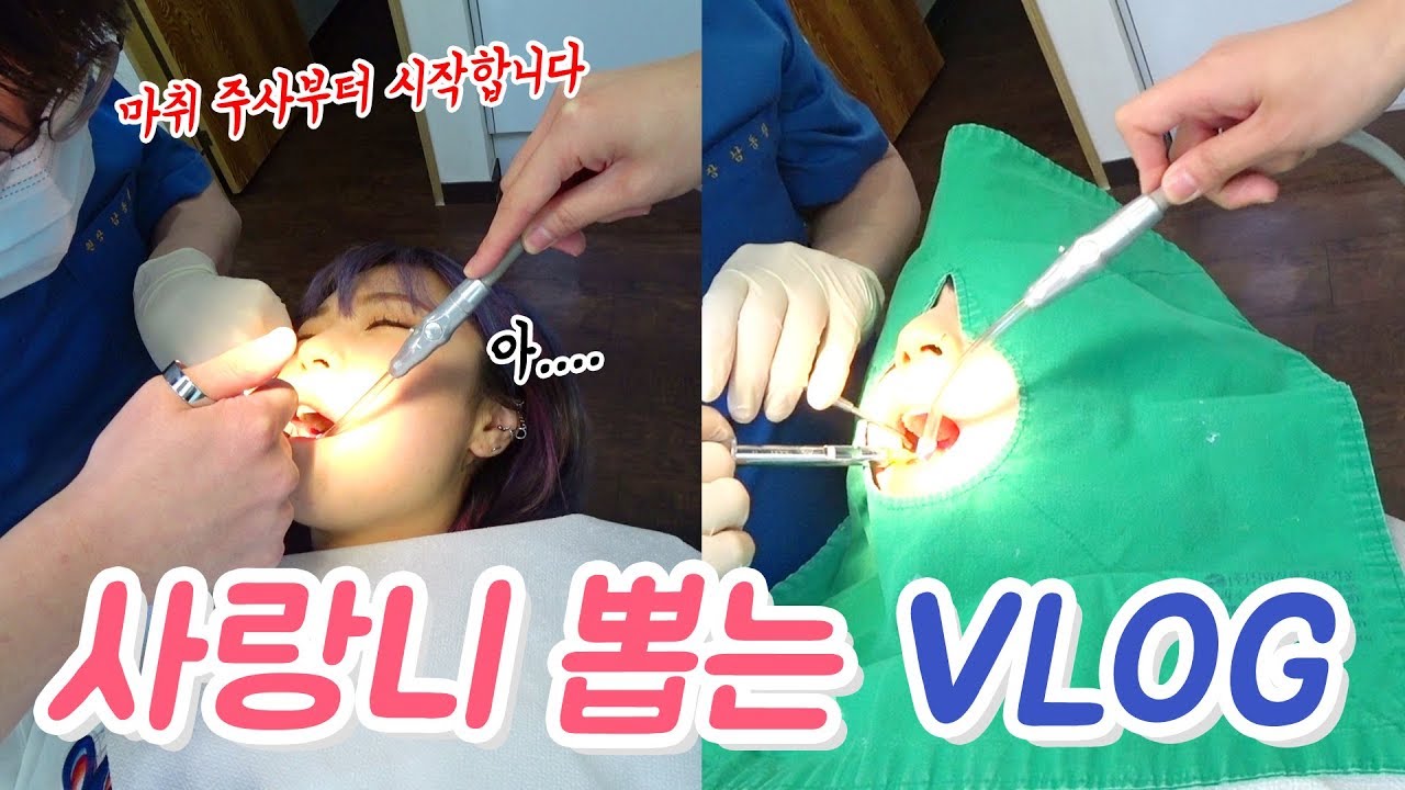 공포의 사랑니 뽑았습니다...ㅠ_ㅠ 마취 주사부터 뽑기 고통후기 VLOG (ENG,JP SUB)