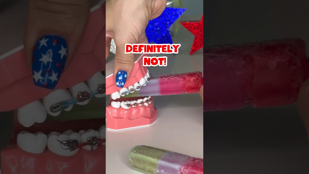 How NOT to eat JOLLY RANCHERS with BRACES #braces #candy #crunchy