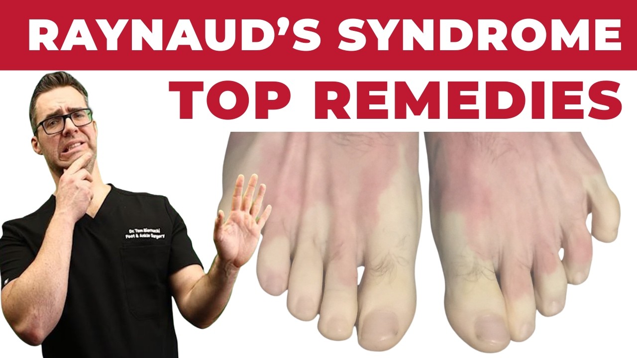 Raynaud's Syndrome Top 15 Remedies [Symptoms & Best Treatment]