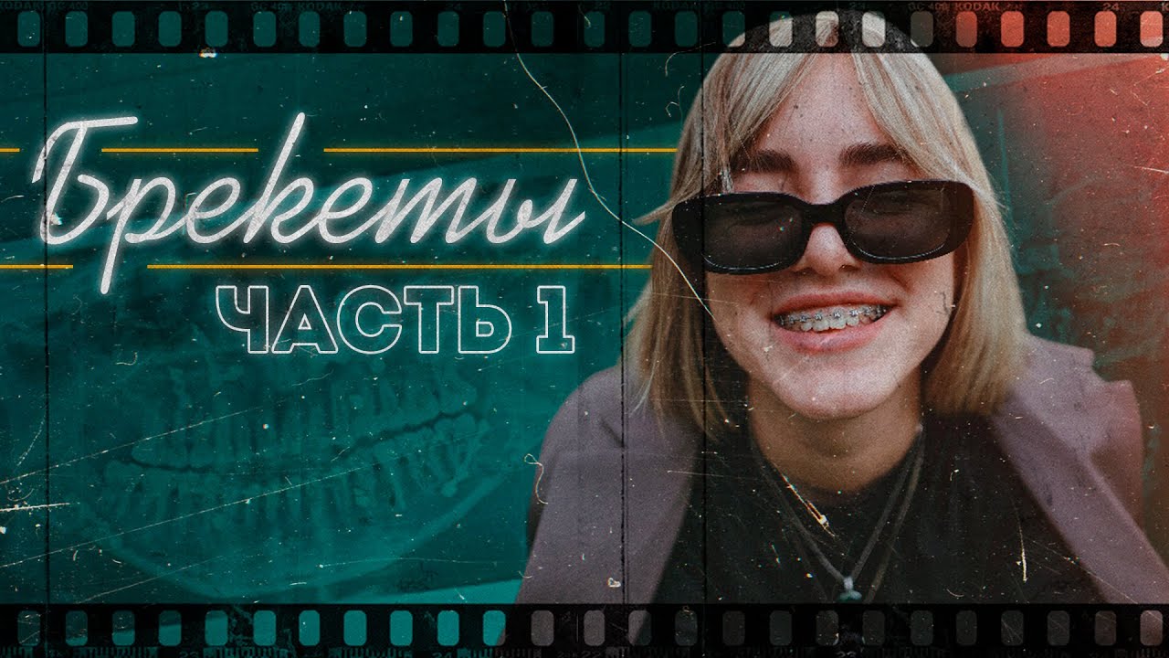 БРЕКЕТЫ | ДИСТРАКТОР | ДВУХЧЕЛЮСТНАЯ ОПЕРАЦИЯ (Часть №1)