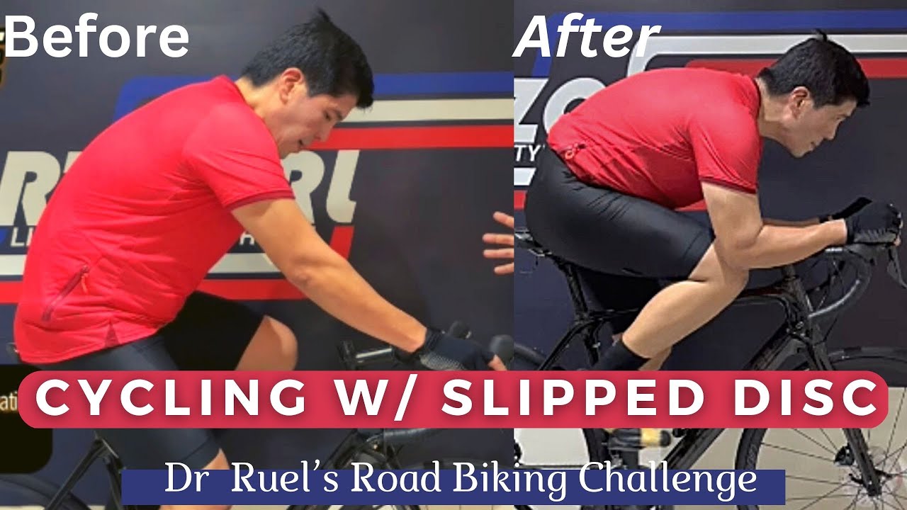 A Surgeon’s Biomechanics experience