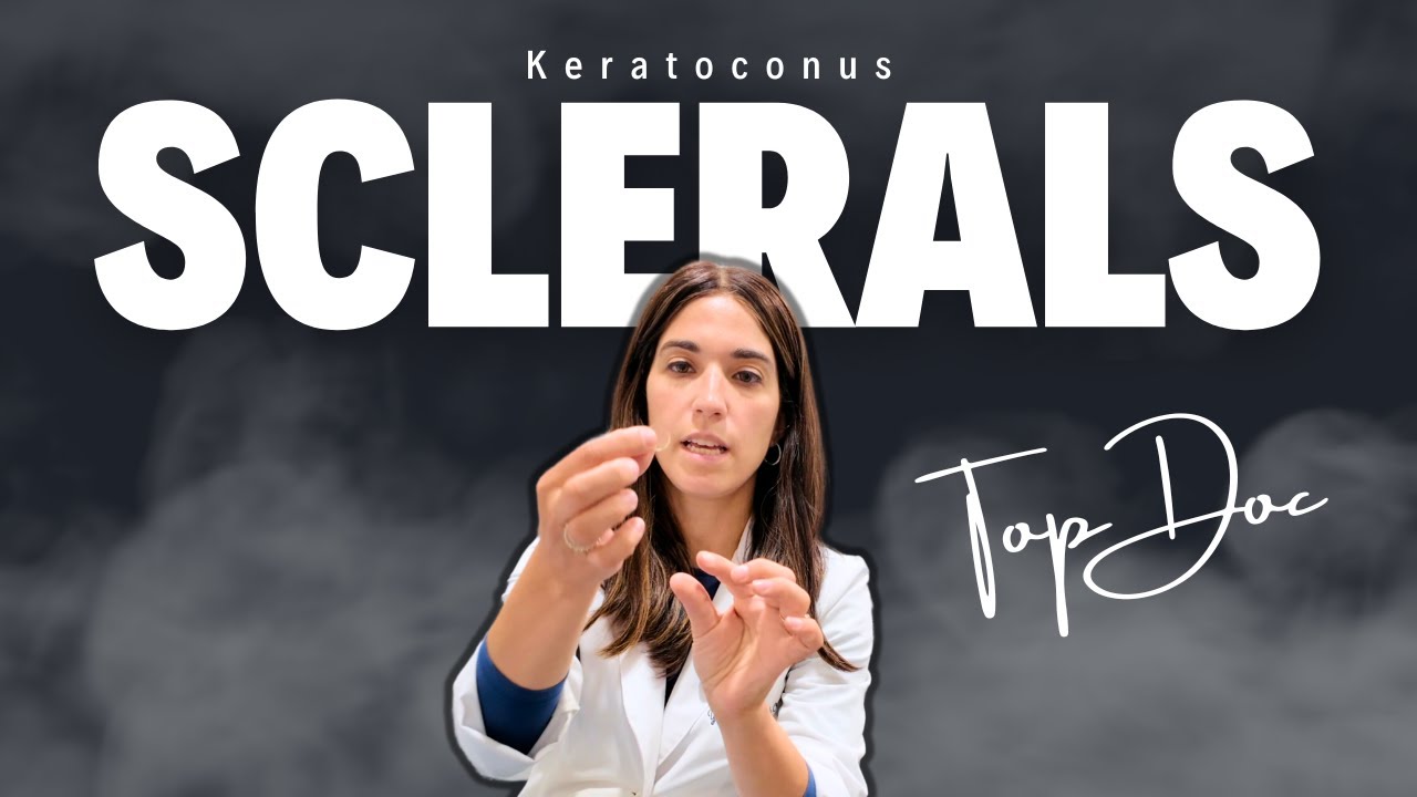 Watch this before choosing sclerals for keratoconus