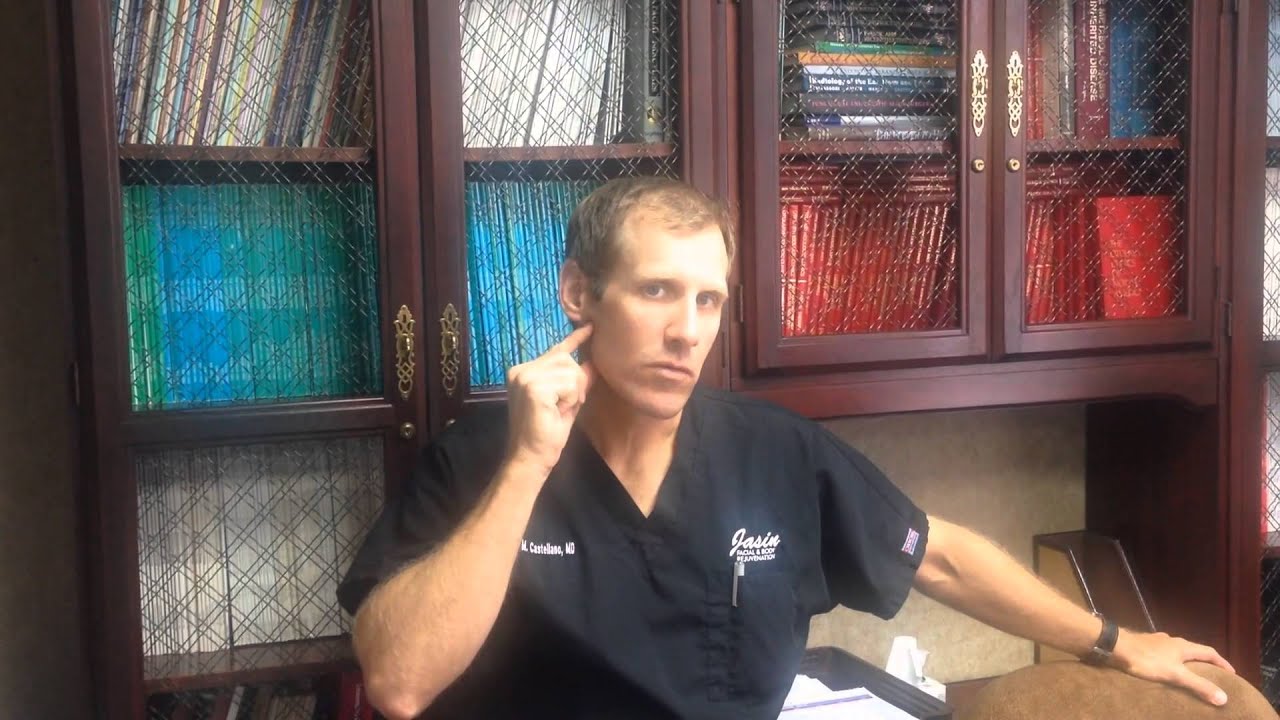 tampa facelift procedure by dr castellano