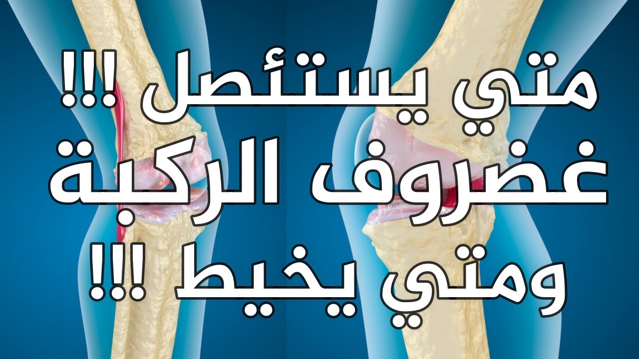 متى استئصل غضروف الركبة ومتى اخيطة؟؟