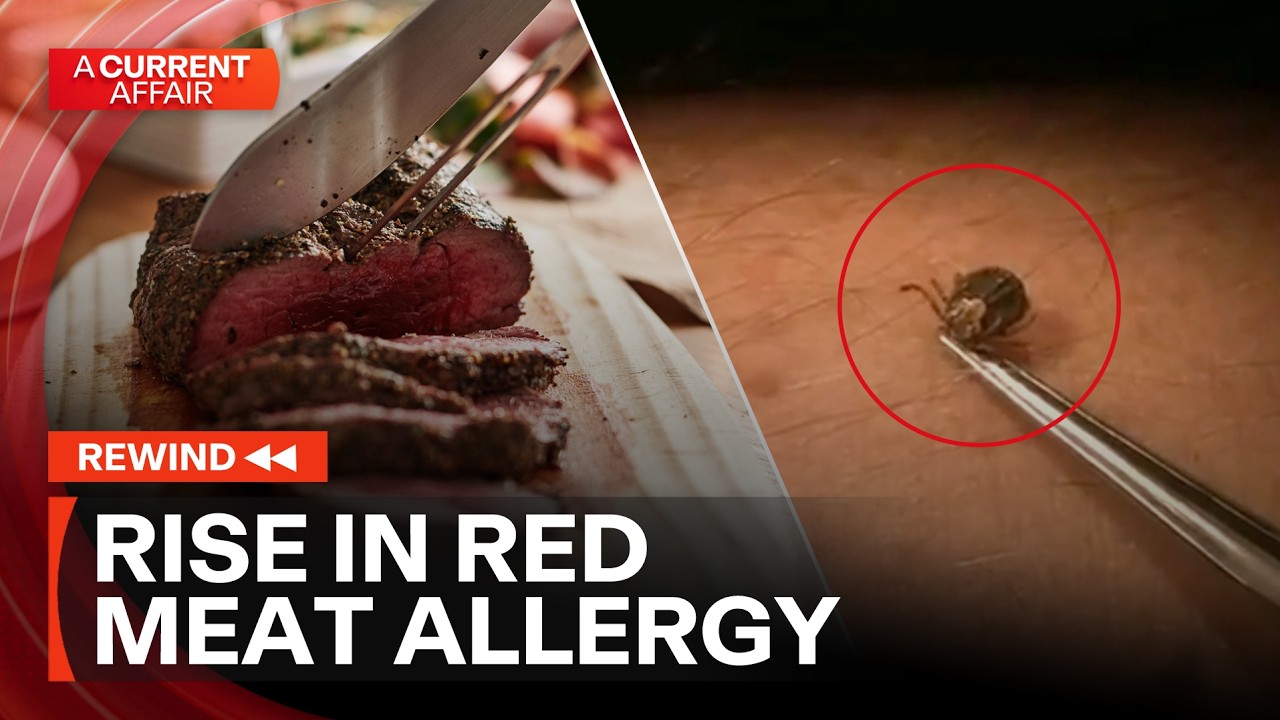 Rising threat of mammalian meat allergies in Australia | ACA Rewind