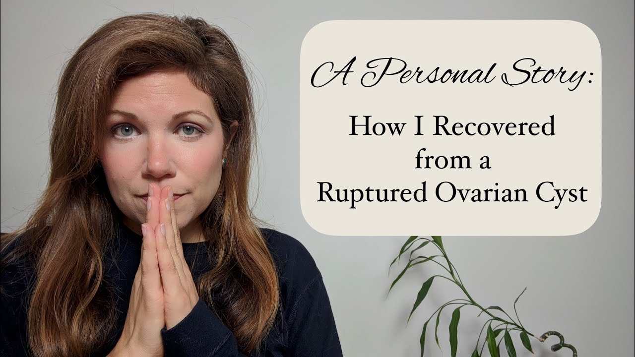 How I Recovered from a Ruptured Ovarian Cyst