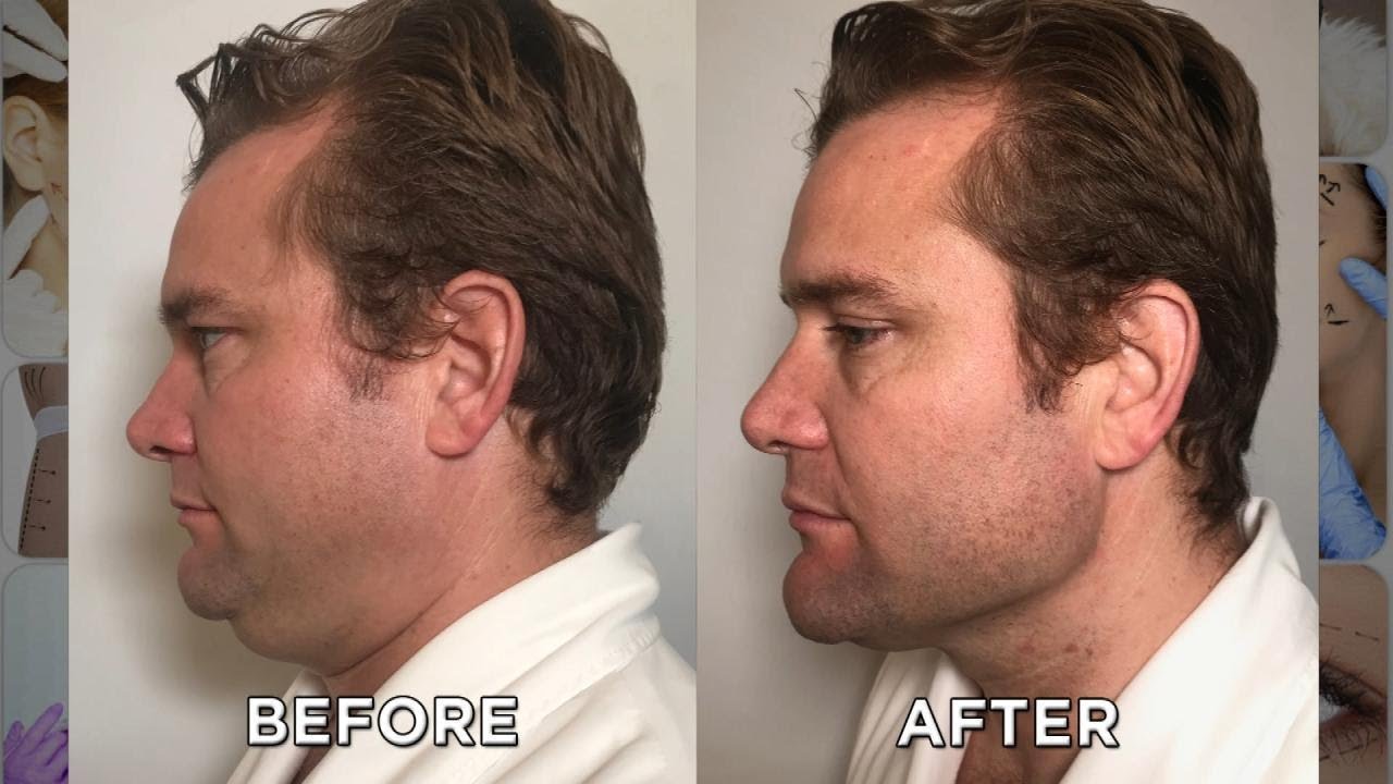 Can This Couple Lose Their Double Chins Together?