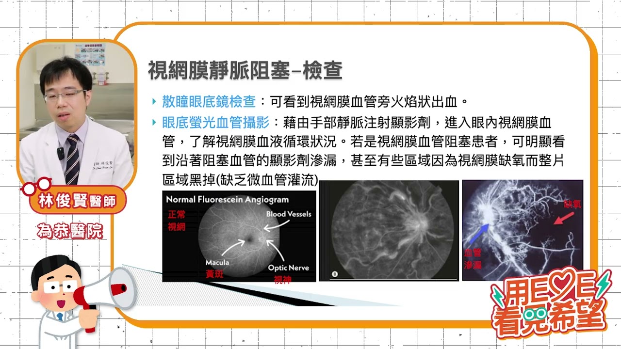 視網膜靜脈阻塞俗稱眼中風：為恭醫院林俊賢主任｜用Eye看見希望-視網膜名醫系列講座