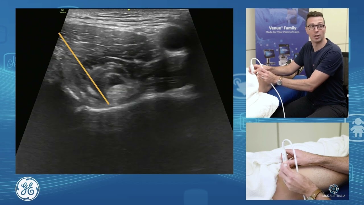 Venue Family | Anterior hip assessment and injection