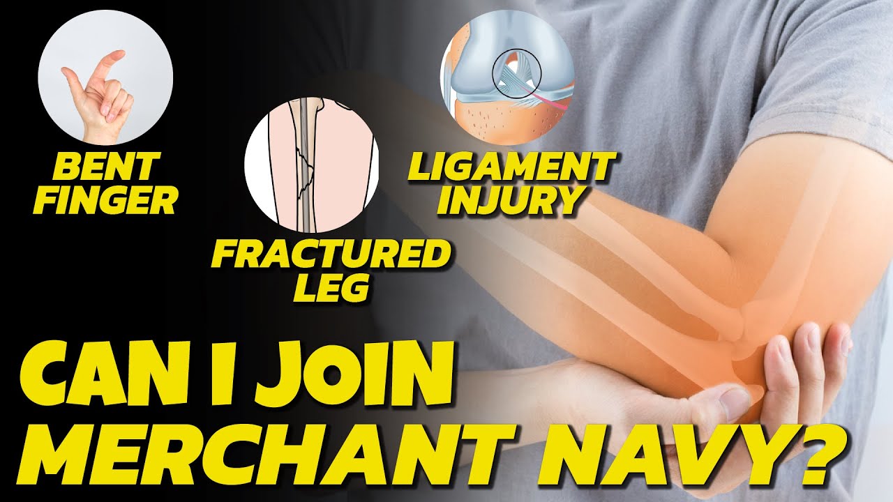 Can I Join Ship With Broken Finger | Merchant Navy Medical Test