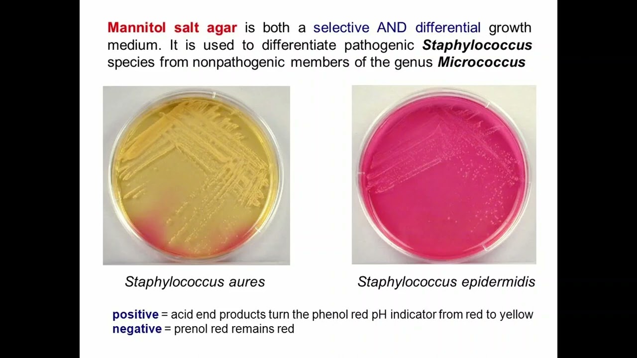 Cocci