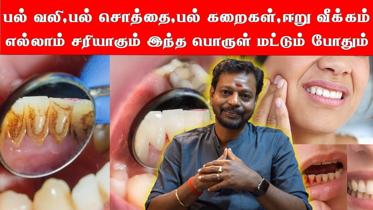 பல் வலி , பல் சொத்தை, பல் கறைகள், ஈறு வீக்கம், எல்லாம் சரியாகும் இந்த பொருள் மட்டும் போதும்