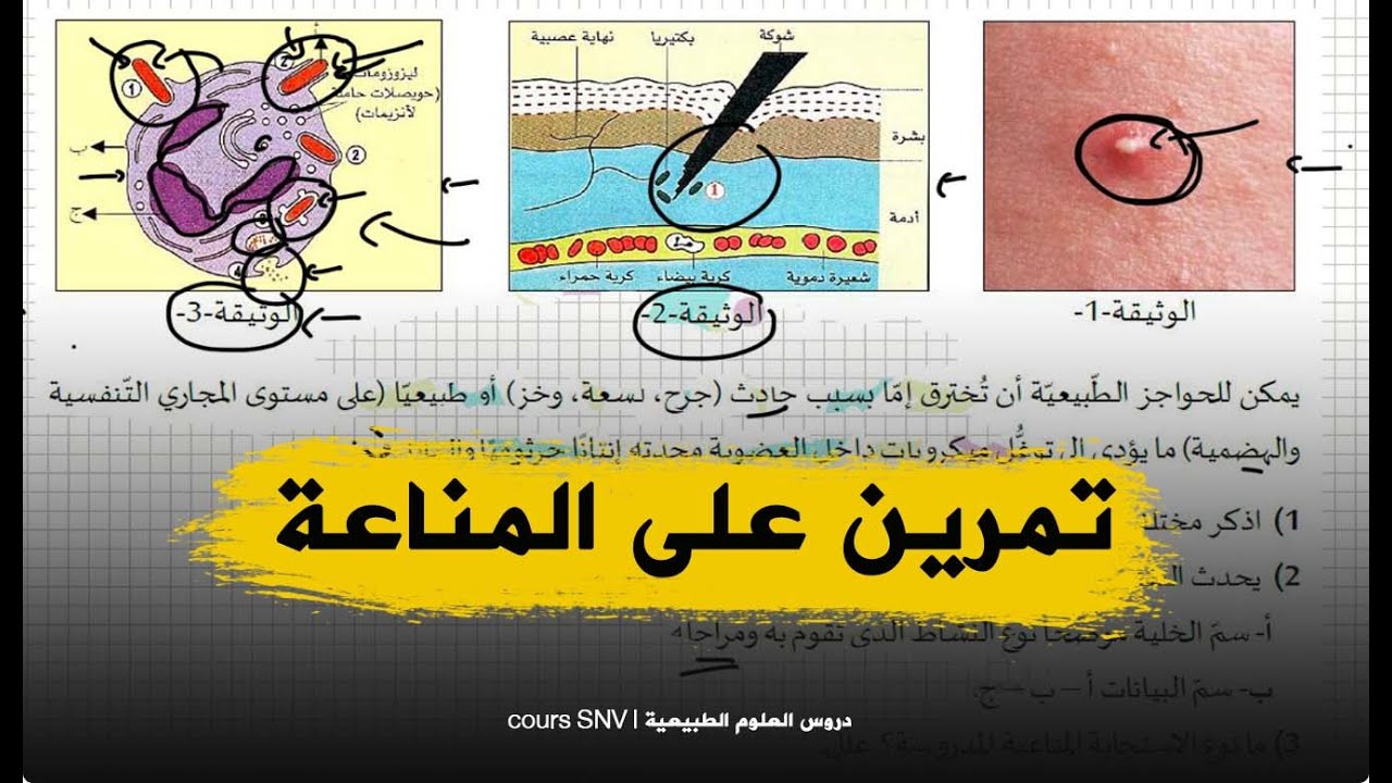 تمرين حول المناعة للتحضير الجيد لشهادة التعليم المتوسط