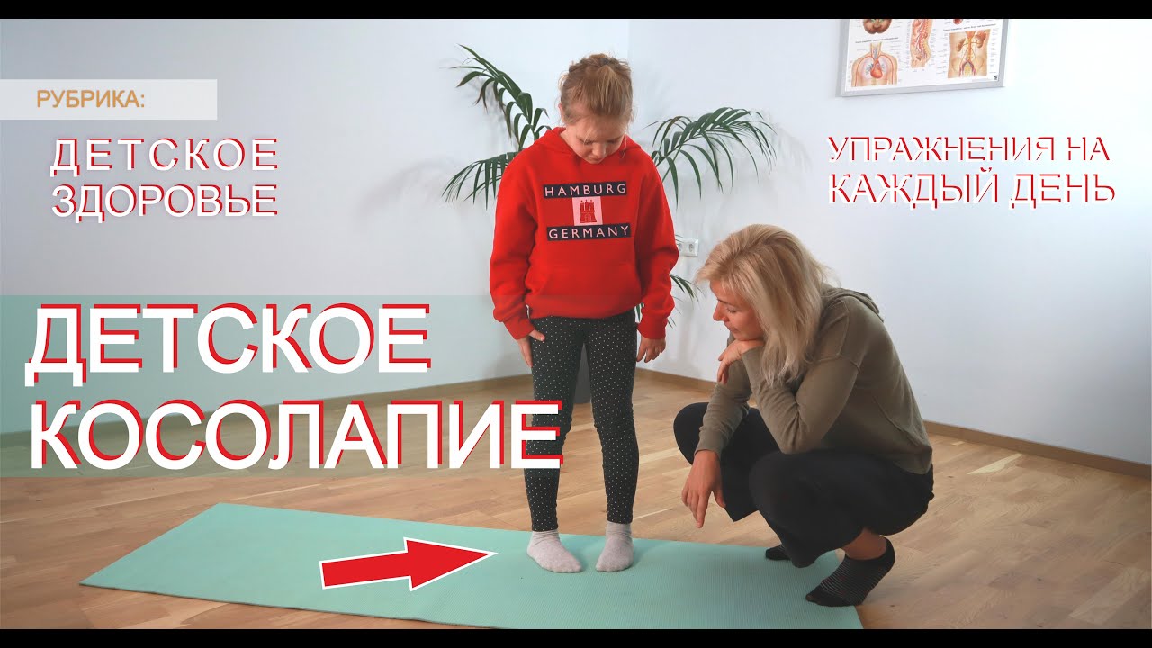 ДЕТСКОЕ КОСОЛАПИЕ: ЧТО ДЕЛАТЬ?