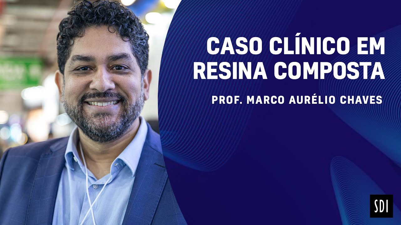 Caso clínico - Facetas Diretas em Resina Composta - SDI AURA