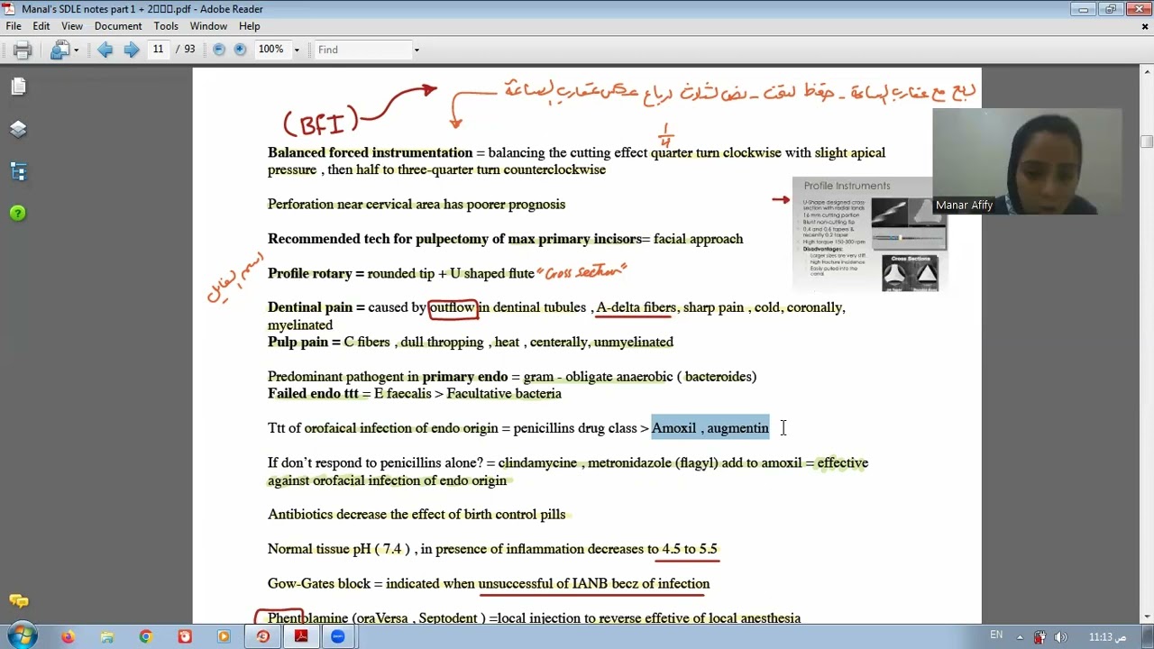 جزء منال ف الاندو  #أسنان #أسنان #برومترك_السعوديه #برومترك_قطر #برومترك_دبي ...لازم ف الامتحان