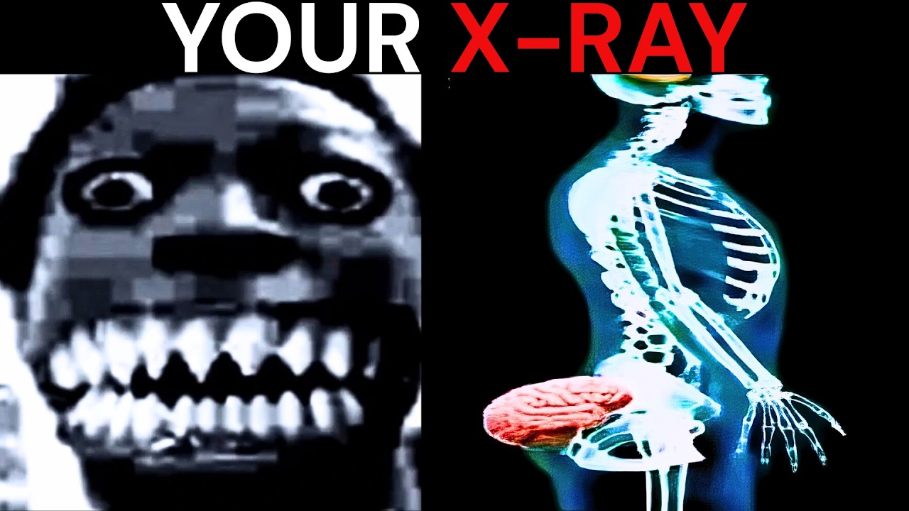 Mr Incredible Becoming Uncanny meme (Your X-ray) | 50+ phases