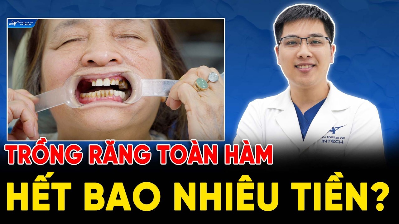 Bạn phải làm gì khi mất răng toàn hàm? video chi tiết NHẤT ĐỊNH phải xem trước khi trồng implant