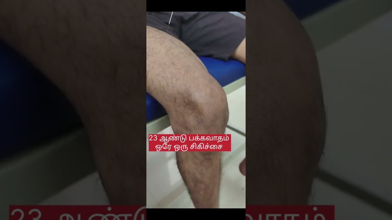 பக்கவாதம் தனிச்சிறப்பு சிகிச்சை மையம் டாக்டர்.M.காமராஜ் call:9894707132