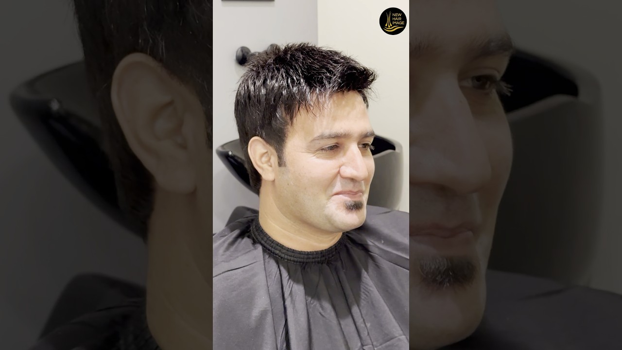 100% Natural Hair Patch in Islamabad and Lahore by New Hair Image