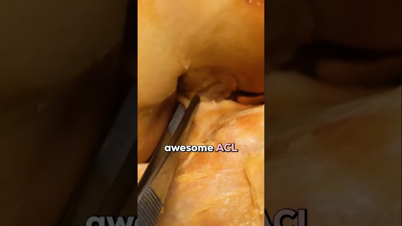 REAL Human ACL & How It Functions