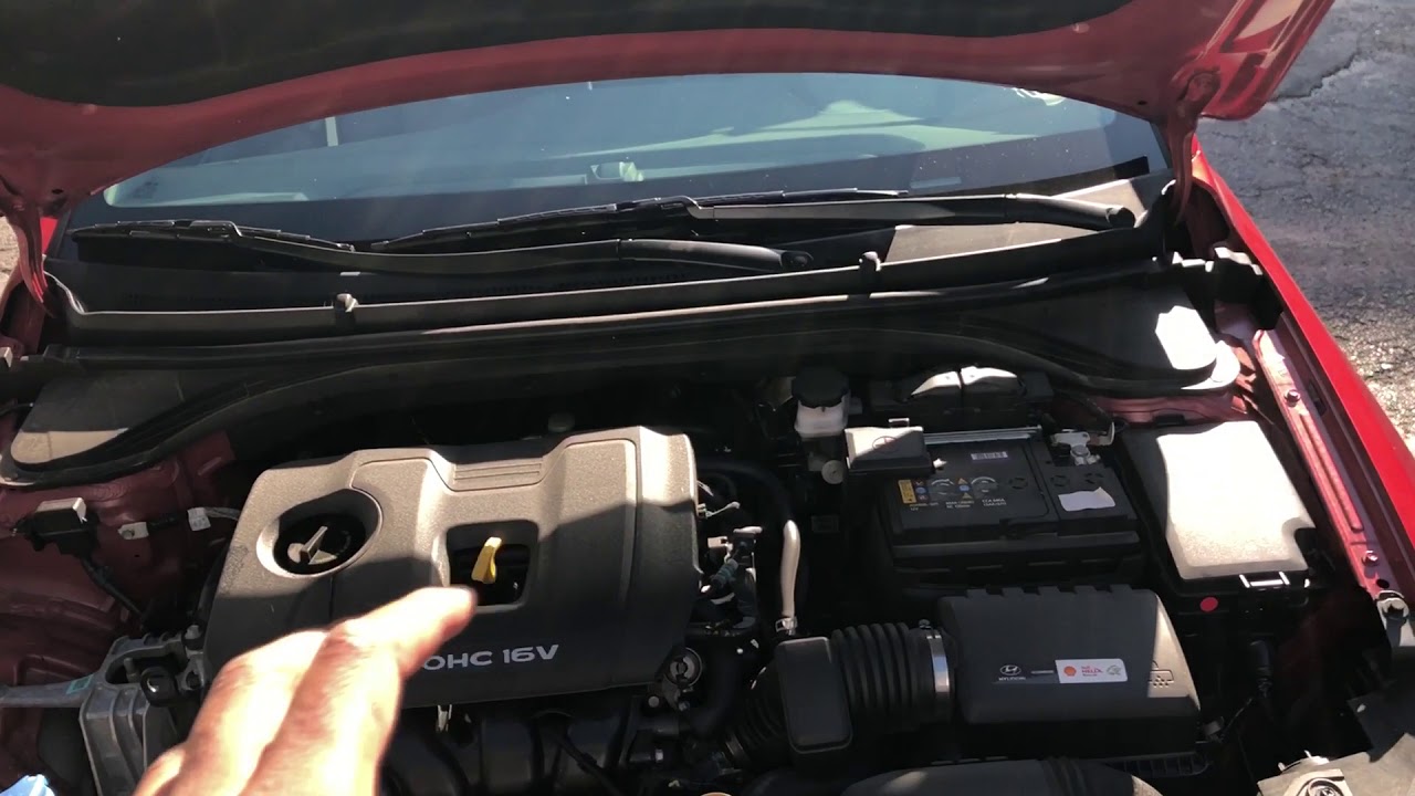 Adding Coolant - Hyundai Elantra