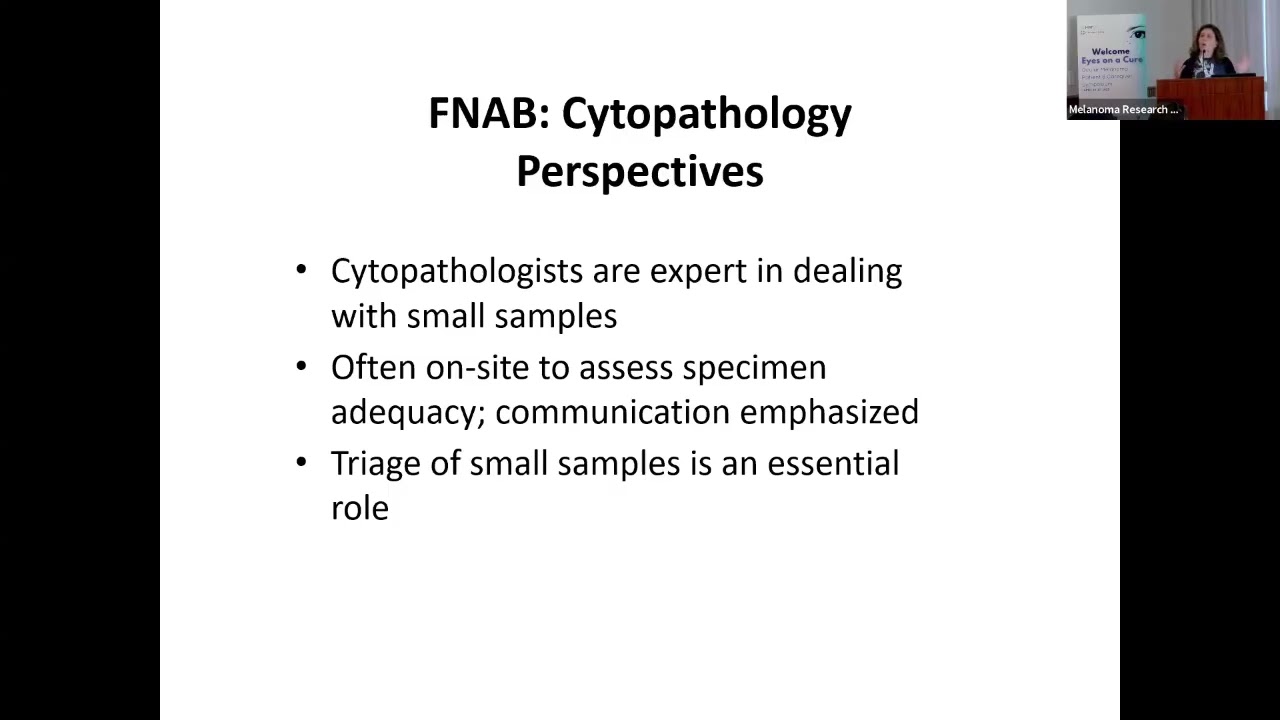 Under the Microscope- Pathology Diagnosis of Ocular Melanoma