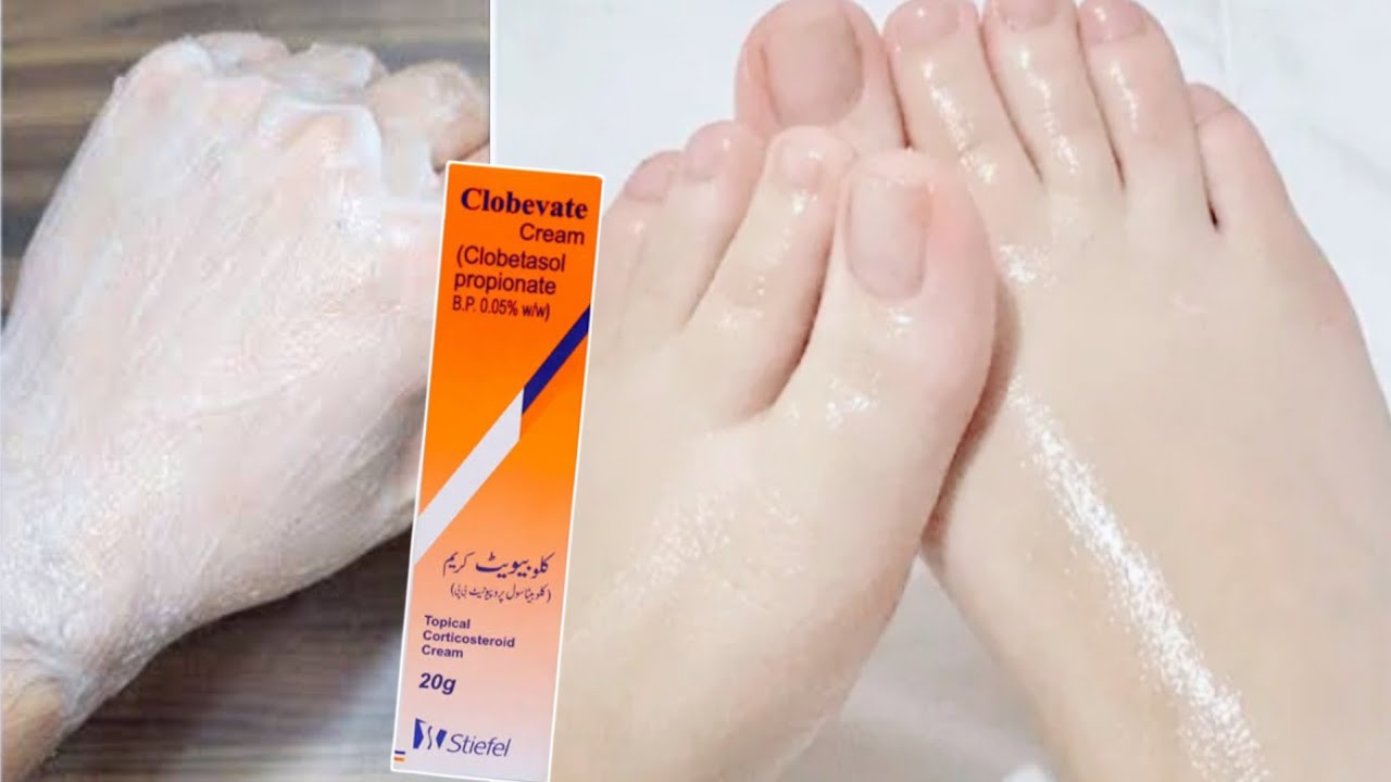 Add Just 2 Things In Clobevate Tube & See The Magical Results || Hand Whitening With Clobevate Cream