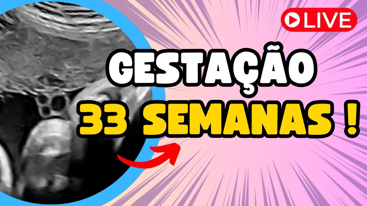 GESTAÇÃO 33 SEMANAS