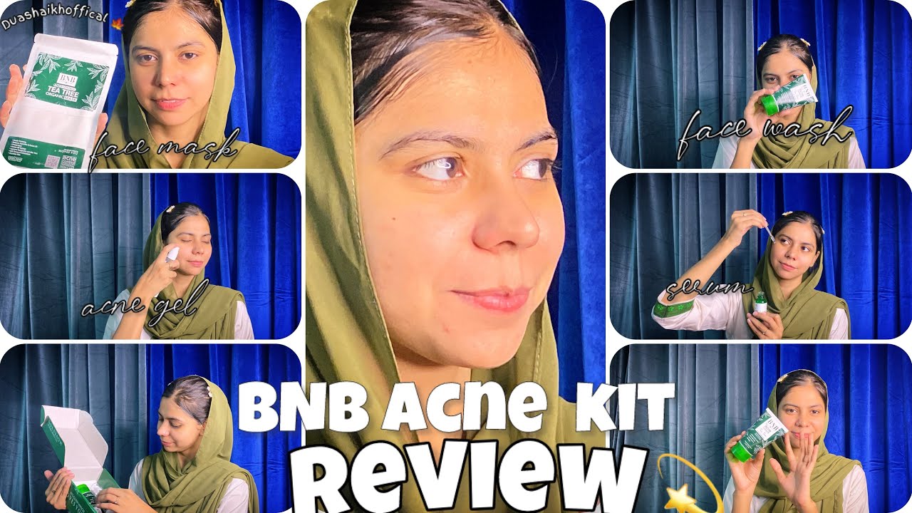 BNB acne kit review skincare products review daraz perchase