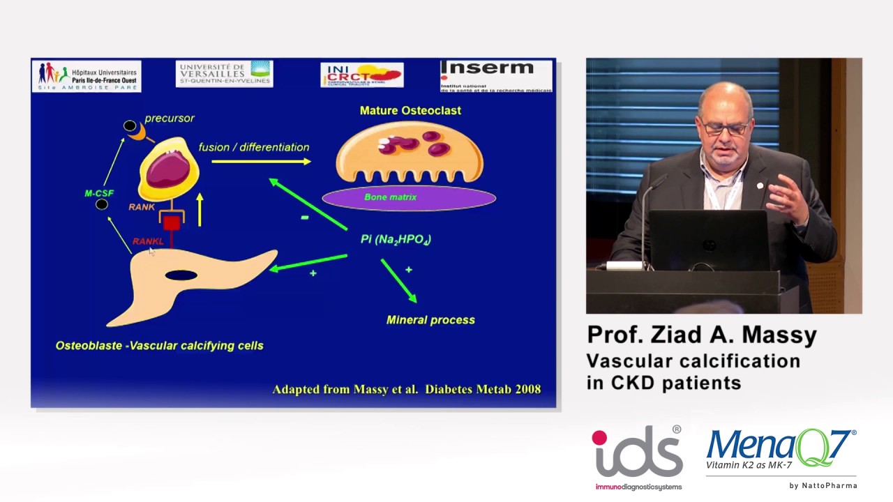 Vascular calcification in CKD patients - Prof. Ziad A. Massy