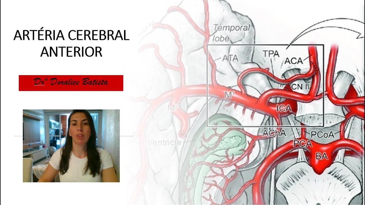 ARTERIA CEREBRAL ANTERIOR