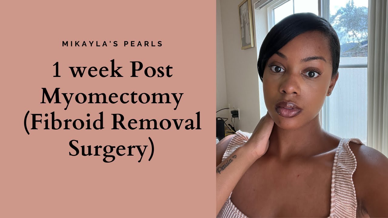 1 week Post Myomectomy (Fibroid Removal Surgery)