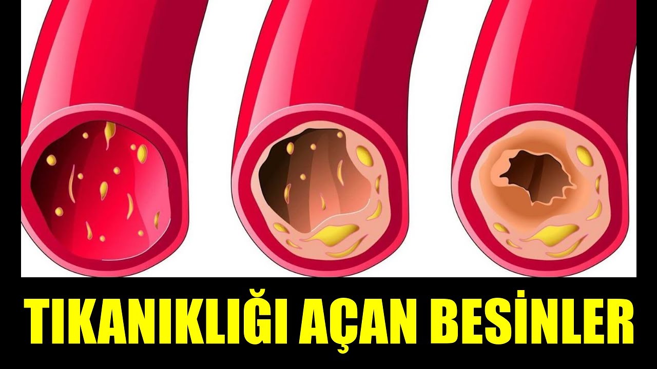 DAMARLARI TEMİZLEYEN 8 YİYECEK