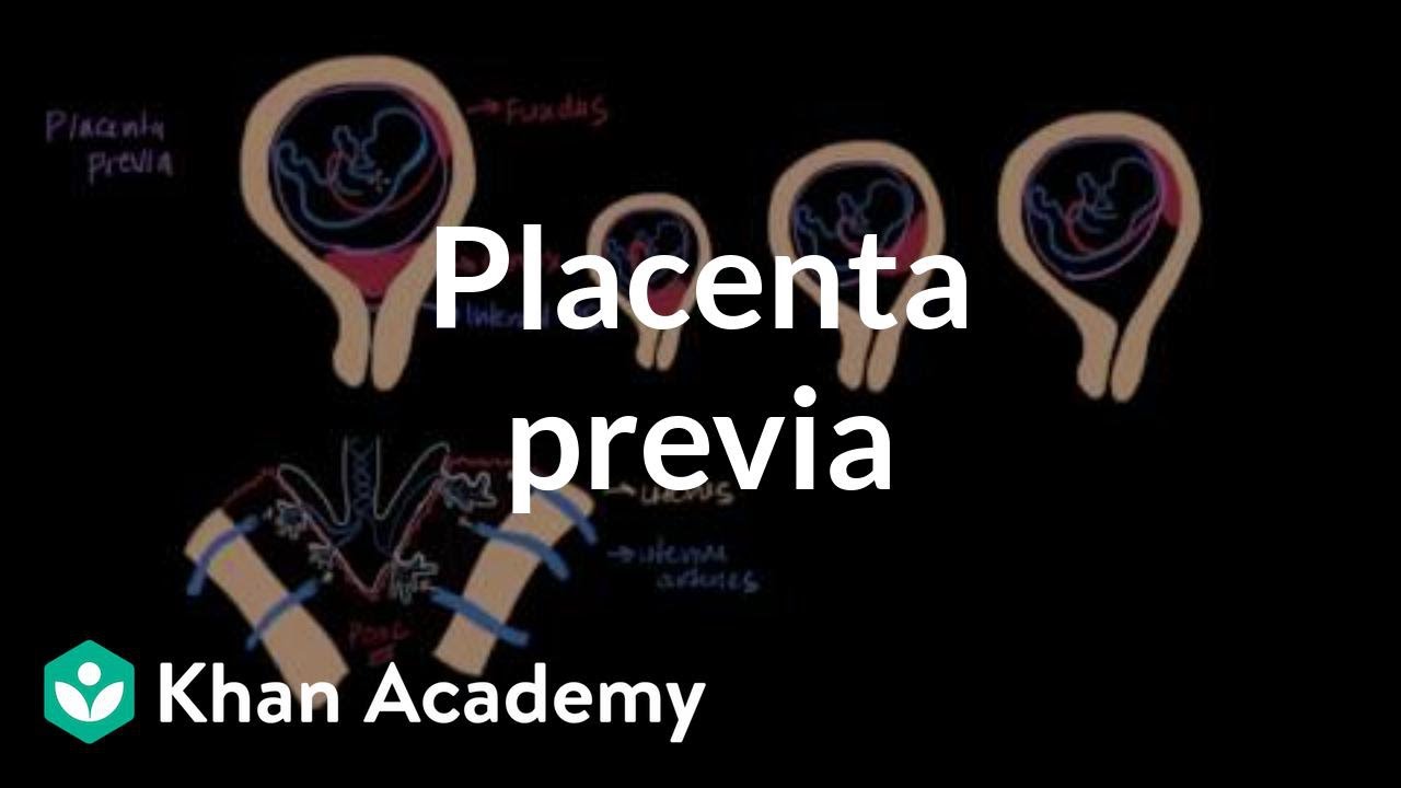 Łożysko przodujące | Fizjologia układu rozrodczego | NCLEX-RN | Khan Academy