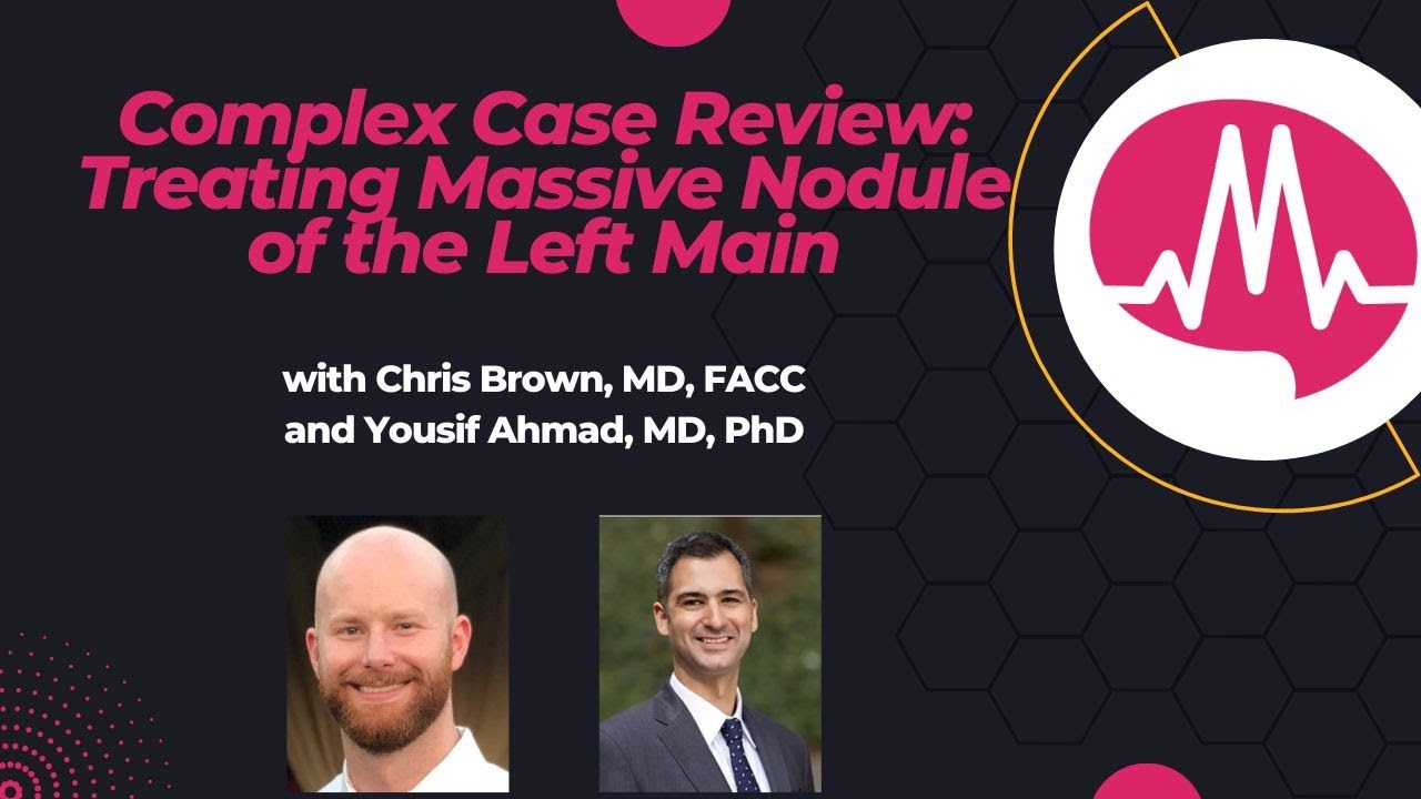 Complex Case Review: Treating Massive Nodule of the Left Main with Shockwave IVL