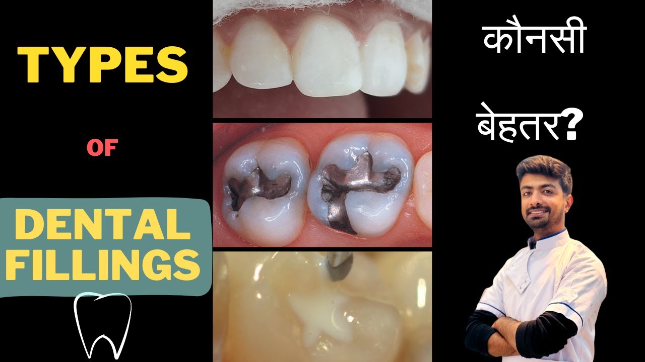 TYPES OF DENTAL FILLINGS | WHICH ONE IS BEST