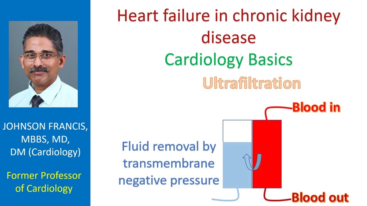 Heart failure in chronic kidney disease (CKD) - Cardiology Basics