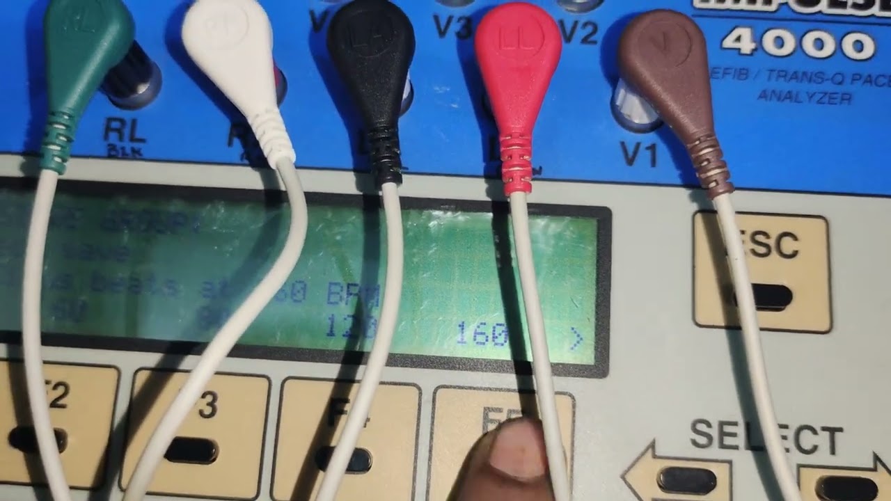 Defibrillator Analyzer