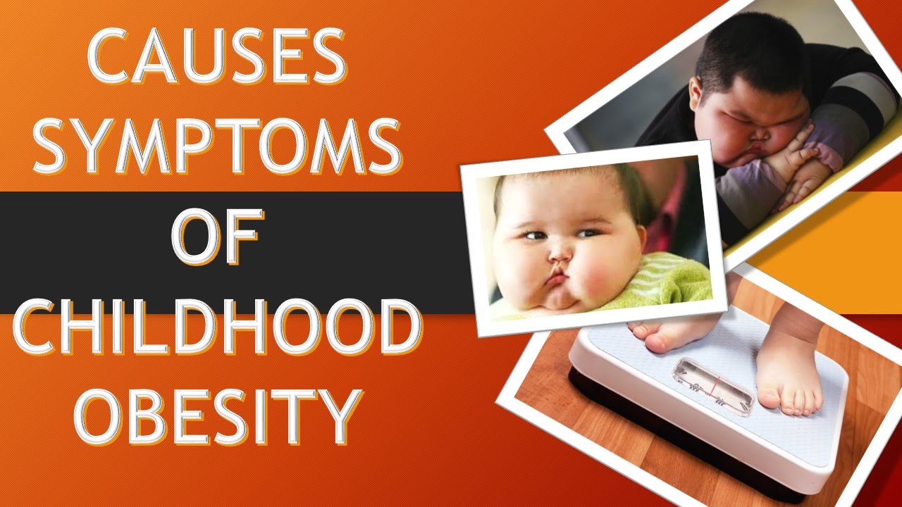 CAUSES SYMPTOMS OF CHILDHOOD OBESITY AND PREVENTION