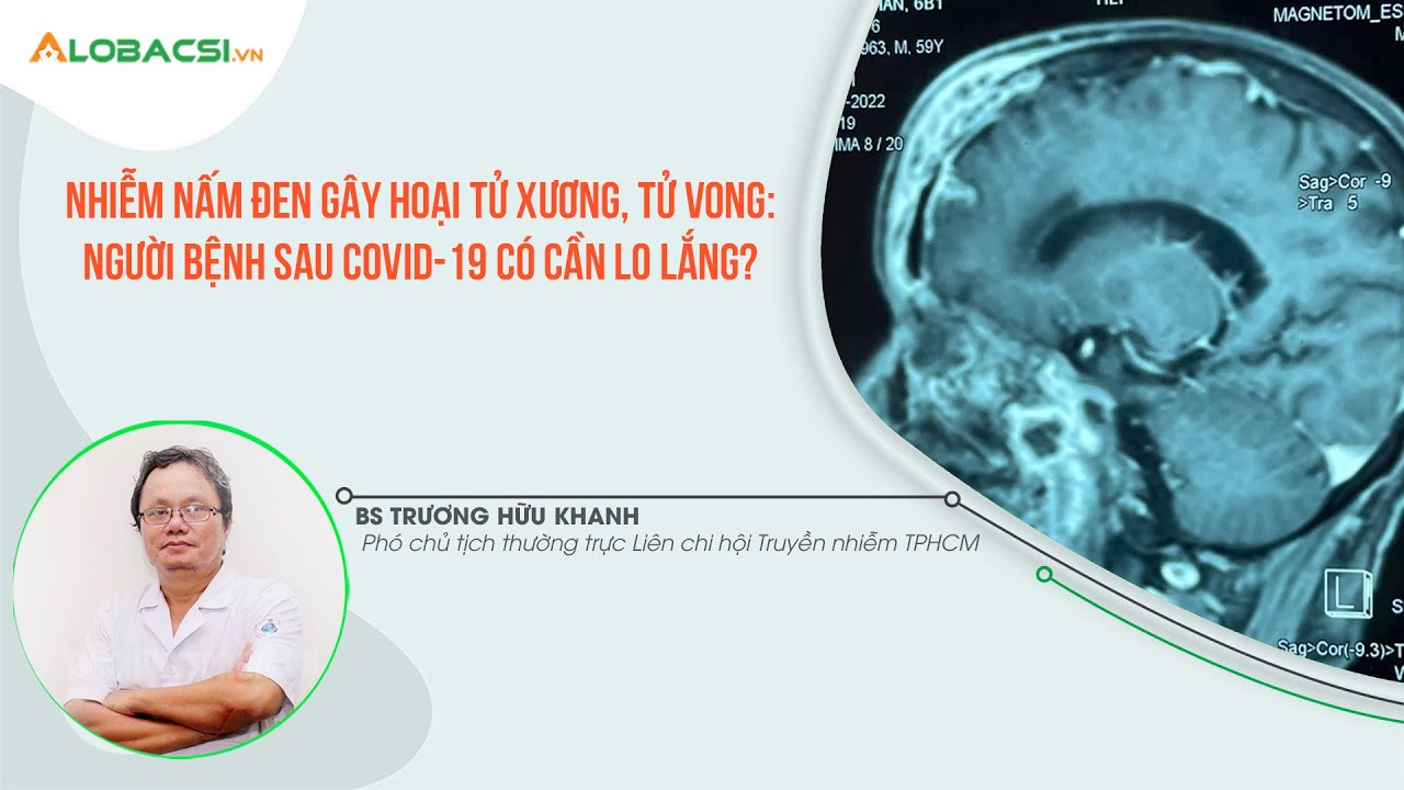 Nhiễm nấm đen g&acirc;y hoại tử xương, t.ử v.o.n.g: Người bệnh sau COVID-19 c&oacute; cần lo lắng?