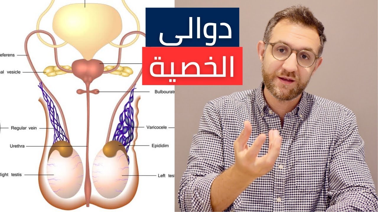 ألم الخصية | دوالي الخصية