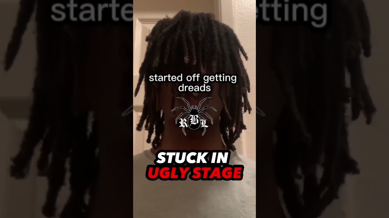 being stuck in the ugly stage of getting dreads #shorts #youtubeshorts #video #dreadlocks #dreads