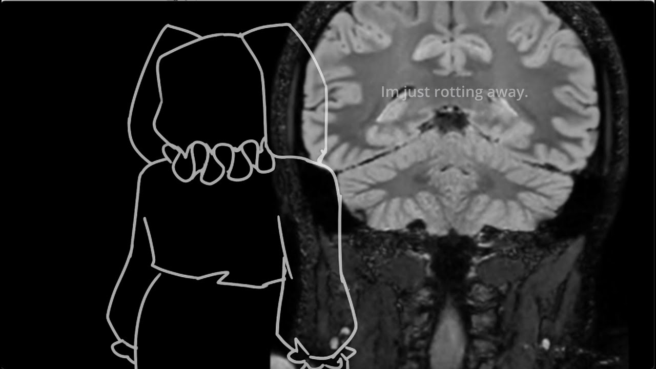 I used my MRI for this music video