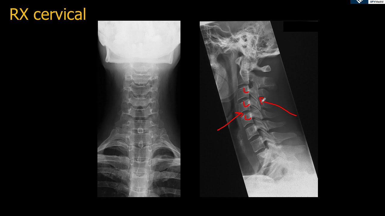 Anatomía Rx Simple Cervical