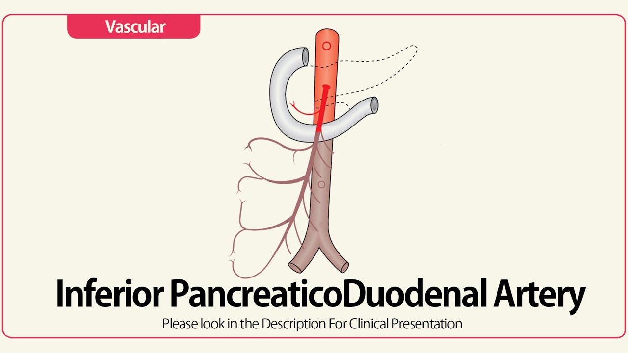 Inferior PancreaticoDuodenal Artery
