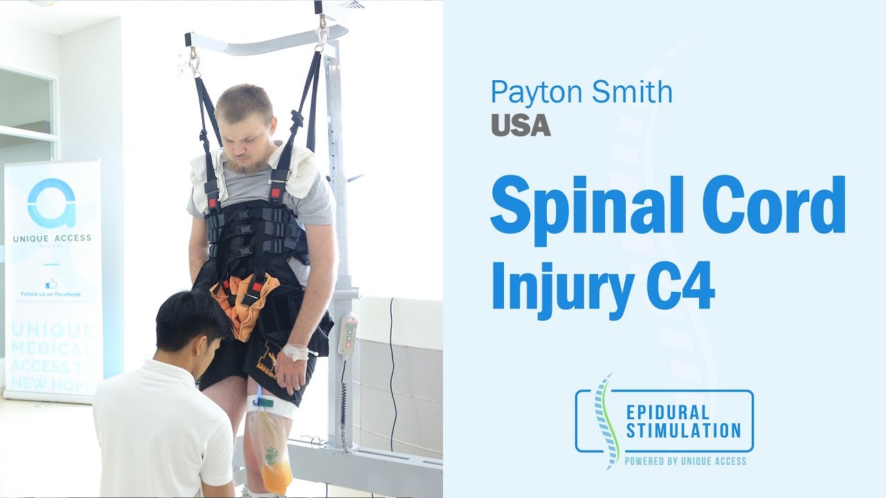 American C4 SCI Patient Payton is Back on His Feet After the Epidural Stimulation Surgery