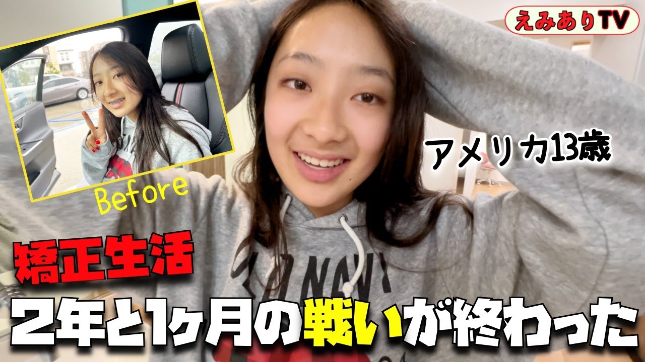 【２年１ヶ月】長かった矯正生活に終止符！垢抜けたアメリカ中２女子の撃沈と栄光の全記録！