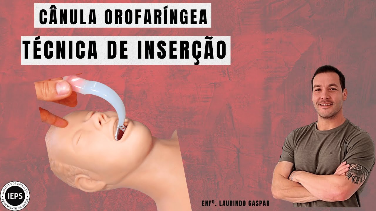 C&acirc;nula Orofar&iacute;ngea (C&acirc;nula de Guedel). Demonstra&ccedil;&atilde;o da T&eacute;cnica de Inser&ccedil;&atilde;o.