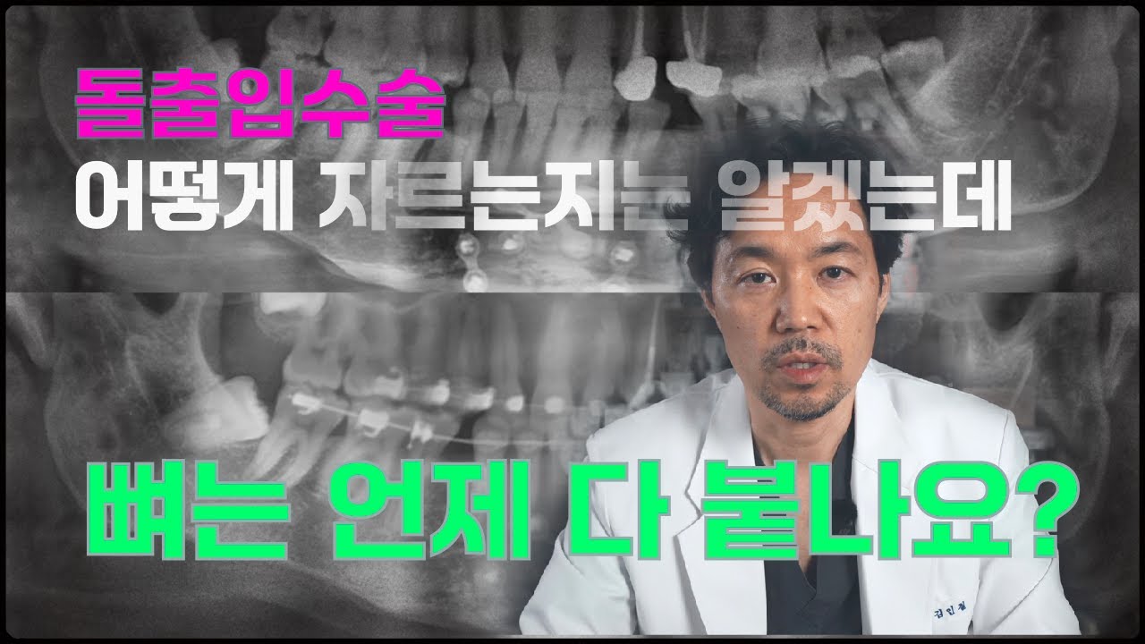 돌출입수술을 하면 뼈와 뼈사이 공간은 언제면 튼튼하게 붙어서 아무 걱정없이 생활할 수 있는지 궁금하네요